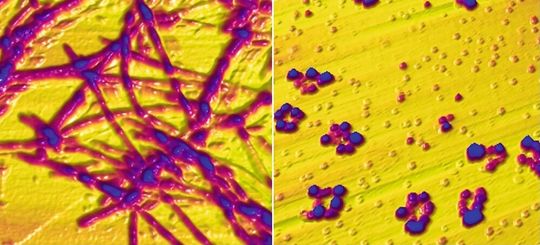 Aufnahmen mit dem Rasterkraftmikroskop zeigen Alpha-Synuclein in Form von Fibrillen (links). Die Fibrillen sind wenige 100 Nanometer bis zu einem Mikrometer lang. Wird das Eiweiß in eine Kupfer-haltige Lösung gebracht, bilden sich stattdessen ringförmige Strukturen aus (rechts). Diese Oligomere sind rund 6-8 Nanometer groß. (Bild:  Empa)