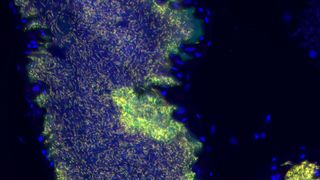 Bakterielle Symbionten (Burkholderia gladioli) bewohnen Reservoire im Fortpflanzungssystem des Wollkäfers Lagria villosa. (Ausschnitt) ((c) Paul Gaube und Laura V. Flórez, Johannes-Gutenberg-Universität Mainz)