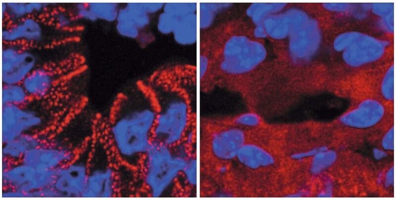 In gesunden Mäusen wird das rot markierte Protein (Desmoplakin) von den Darmzellen in Desmosomen eingebaut (links). Ein fehlerhafter Insulinsignalweg führt zum Verbleib des Proteins im Zellplasma (© Max-Planck-Institut für Stoffwechselforschung / Ostermann)