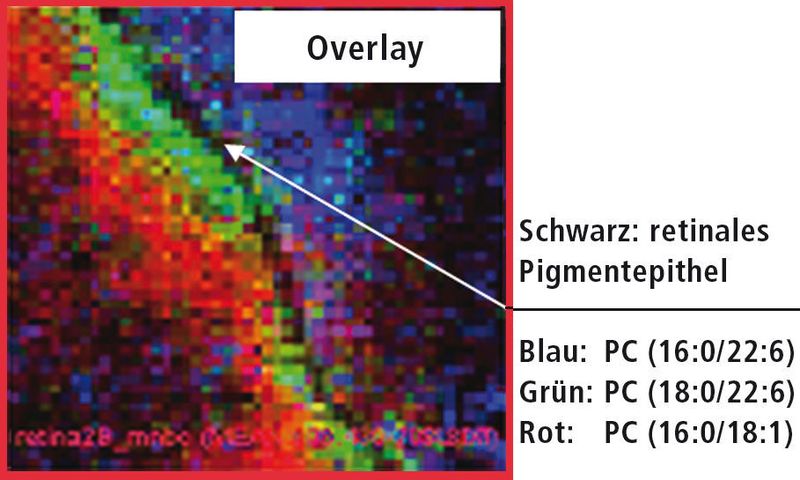 Abb. 4: Überlagerung der MS-Bilder von drei verschiedenen Lipiden der Retina (Bild: Shimadzu Deutschland)