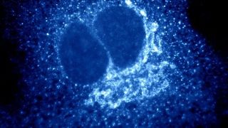 Abb. 1: Protein-befüllte COP I Transportvesikel wurden mittels einer Immunfluoreszenzfärbung in einer Fibroblastenzelle sichtbar gemacht. (Bild: Dr. Irina Majoul, Institut für Biologie, Universität Lübeck)