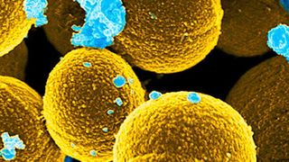 Bei Antibiotika-Resistenz gefährlich: Staphylococcus-aureus-Bakterien (rund/gelb) können u.a. Lungen-, Herz- und Hirnhautentzündung sowie Sepsis verursachen. Hier beim Versuch, weißen Blutkörperchen (blau) zu entkommen, die für die Infektabwehr zuständig sind (National Institute of Allergy and Infectious Diseases (NIAID), USA)