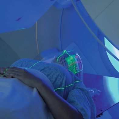 Strahlentherapien können stark beeinträchtigende fibrotische Hautschädigungen verursachen. Ein Schlüsselfaktor bei der Entstehung dieser Strahlenschäden ist das Protein Dickkopf-3, wie Forscher des DKFZ nun gezeigt haben. (Symbolbild) (Bild: © Mark Kostich - stock.adobe.com)