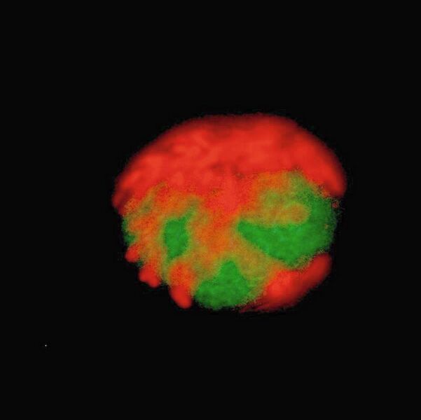 Dinoflagellat Alexandrium, der vom Parasiten Amoebophrya befallen ist, unter dem Epifloureszenz-Mikroskop. Der Plastid des Wirtes ist rot, das Cytoplasma des Parasiten grün. (Yameng Lu)