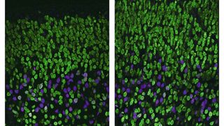 Nervenzellen in den tiefen (Magenta) und oberen (grün) Neokortex-Schichten bei Mäusen mit kurzer (l.) und langer (r.) Tragezeit. Man erkennt die Nervenzell-Zunahme in den oberen Schichten im Mausembryo mit langer Tragezeit. (Stepien, Vaid, Huttner / MPI-CBG)