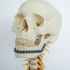 Osteosynthese-Implantat für einen Unterkiefer, ausgerüstet mit einer mittels Micro-Arc-Oxidation hergestellten porösen Oberfläche.(Bild:  Fraunhofer IFAM)