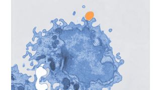 Image au microscope électronique pseudocolorée d'un macrophage (en bleu) absorbant des microplastiques (en orange). (Bild: Mass Lab/Université de Bonn)