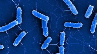 Rasterelektronenmikroskopische Aufnahme von Zellen des E. coli Typstamms DSM 30083T (Bild: Manfred Rohde, Helmholtz-Zentrum für Infektionsforschung; Christine Rohde, Leibniz-Institut DS)