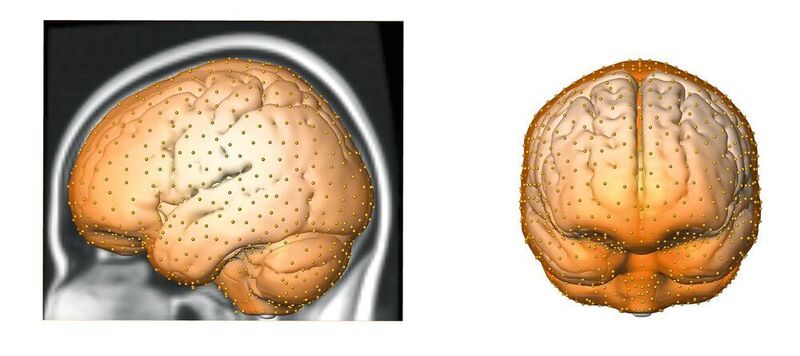 Anhand von hunderten Messpunkten haben die Forscher die Gestalt des Gehirnschädels erfasst und diese zwischen Neandertalern und modernen Menschen verglichen. (Philipp Gunz / CC BY-ND 4.0)