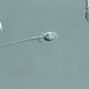 Abb. 2 IMSI-geeignetes Spermium ohne auffällige Morphologie.