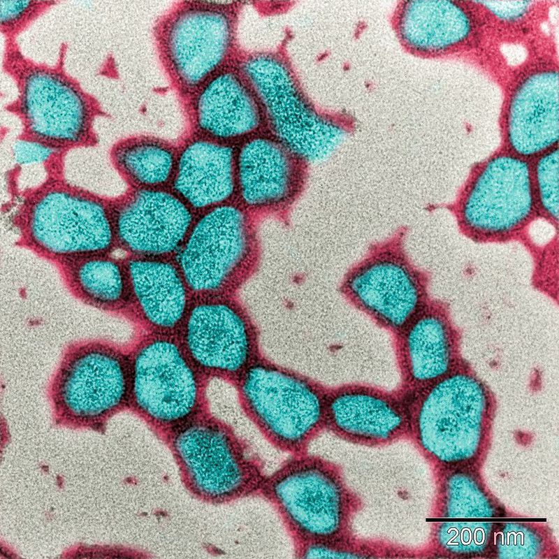Abb. 4: Kolorierte Transmissionselektronenmikroskopische (TEM) Aufnahme der negativ-kontrastierten Octade-cylrhodamin (R18) markierten A/Brisbane/2007-Influenza­viruslösung. Die Virusmembran ist in rot eingefärbt und die Virusmatrix in hellblau