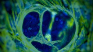 Menschliche Endothelzellen verzweigen und organisieren sich zu Gefässgewebe im carboxylierten Agarosegel. (Bild: Aurelien Forget, Prasad Shastri)