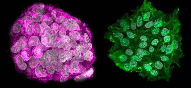 Immunofluorescence microscopy reveals the different protein profiles of immature stem cells (coloured pink) and mature stem cells (coloured green).  (Sarita Panula/Karolinska Institutet)
