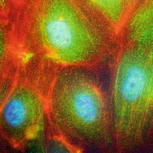 Im Fluoreszenzmikroskop: Zu sehen ist eine Immunfluoreszenzfärbung von menschlichen Endothelzellen, wobei der Zellkern blau ist, bestimmte Zellplasmamarker (genauer Bestandteile des Zellskelets) sind rot und das Protein hnRNPU ist grün dargestellt.(Bild:  Felix Heyder / Uniklinikum Bonn)
