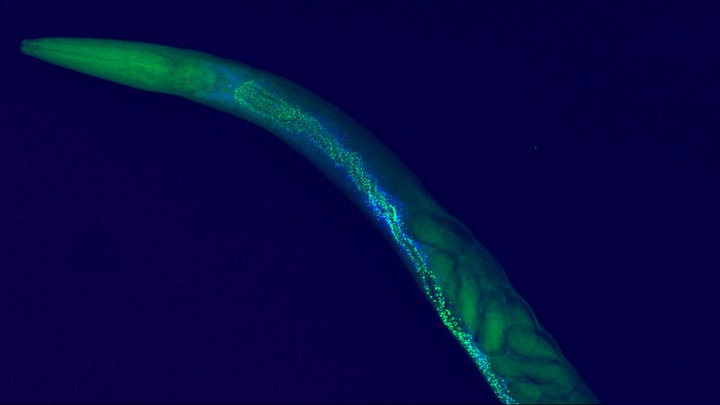 Nanopartikel im lebenden Organismus untersuchen  Ein internationales Forschungsteam hat an DESYs Röntgenlichtquelle PETRA III erstmals einen ganzen Organismus mit so hoher Auflösung abgebildet, dass sich Schadstoffe in einzelnen Zellen nachweisen lassen.  Die Röntgenuntersuchung zeigt Nanopartikel des Seltenerdmetalls Cer im Verdauungstrakt des Fadenwurms Caenorhabditis elegans. Der Wurm wurde weitaus höheren Konzentrationen von Cer ausgesetzt, als sie in der Natur vorkommen, um die Aufnahme der Nanopartikel in den Organismus deutlich zu sehen.   „Die Abbildung von Schadstoffen mit einer Auflösung von 300 Nanometern im Ganzkörper-Röntgenbild eines intakten Organismus ermöglicht uns eine Untersuchung von Schadstoffwirkungen auf völlig neue Weise. Das ist Toxikologie der nächsten Stufe, bei der wir im Detail zeigen können, dass die Gegenwart eines Schadstoffs in einem Gewebe oder einer Zelle in direktem Zusammenhang mit der von ihm verursachten Wirkung steht“, erklärt Ole Christian Lind von der Norwegischen Universität für Biowissenschaften (NMBU).  Hier gehts zur Originalmeldung Wissenschaftsbild des Tages vom 9.6.2022 (Norwegische Universität für Biowissenschaften NMBU)