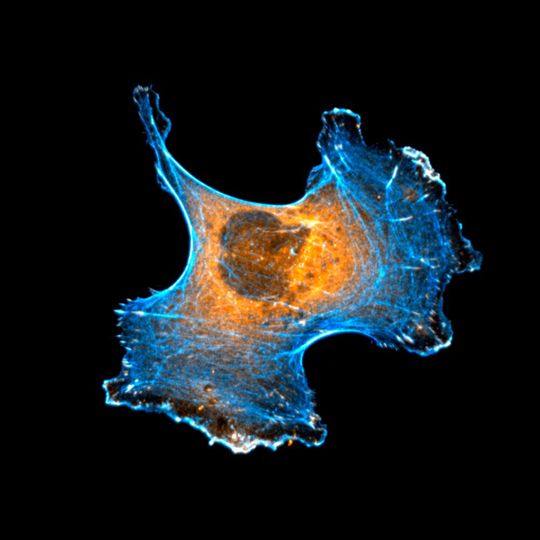 Components essential for cell migration; the cytoskeleton and adhesions are shown in blue and orange. Components essential for cell migration; the cytoskeleton and adhesions are shown in blue and orange.