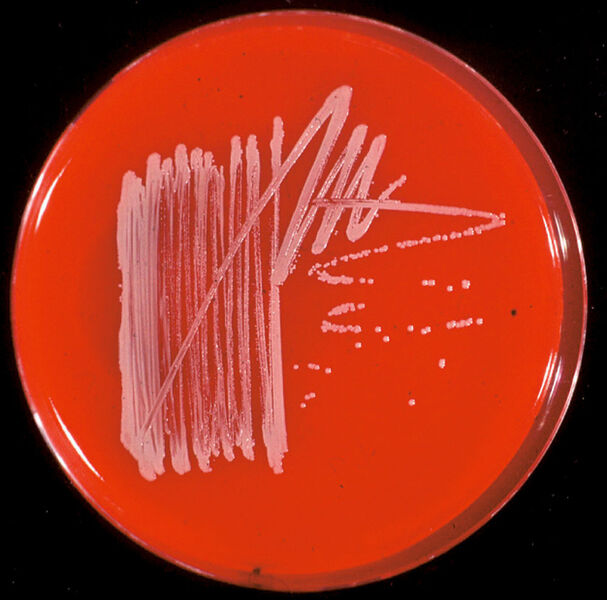 Abb.2: Bakterienkultur
auf Schafsblutagar (Archiv: Vogel Business Media)
