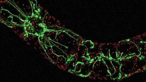 Pflanzen zeigen der Hitze den „Finger“: Geraten Pflanzen durch hohe Temperaturen oder Trockenheit in Stress, bilden sich im Innern der Zellen Ausstülpungen, die Schutzprogramme auslösen.  (Bild: Toranj Rahpeyma, KIT)