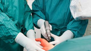 Ein DC-Motor, der in der Nähe des Nennmoments betrieben wird, kann sehr heiß werden. Im Dauerbetrieb erreicht die Wicklung Temperaturen von bis zu 155 °Celsius, was eine Gehäusetemperatur im Bereich von 120 °Celsius ergibt – für Handgeräte ist das nicht tragbar.  (Bergringfoto - Fotolia)