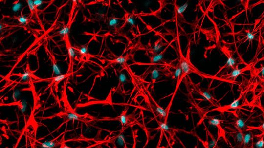 Stammzellen aus dem Knochenmark entwickeln sich im Hydrogel zu einem dreidimensionalen Netzwerk (Mikroskopie).(Bild:  ETH Zürich / Doris Zauchner)