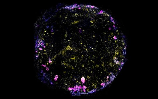 Image of the lung-on-chip, with cell nuclei in blue, macrophage in magenta, endothelial cells in yellow and tight junctions between epithelial and endothelial cells in white.(Source:  Jakson Luk, Science Advances)