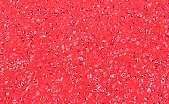 A new study published in the journal Stem Cells could lead to a therapy that does away with joint replacement surgery. (Stem Cells Journal)