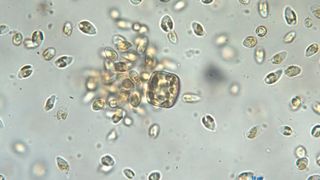 Ein Schwarm von Prymnesien (aus einer Zellkultur des IGB) befällt eine zugegebene Kieselalge. Die Mikroalgen lysieren diese, um den aufgelösten Zellinhalt aufzunehmen. (Bild: Karla Münzner/IGB)