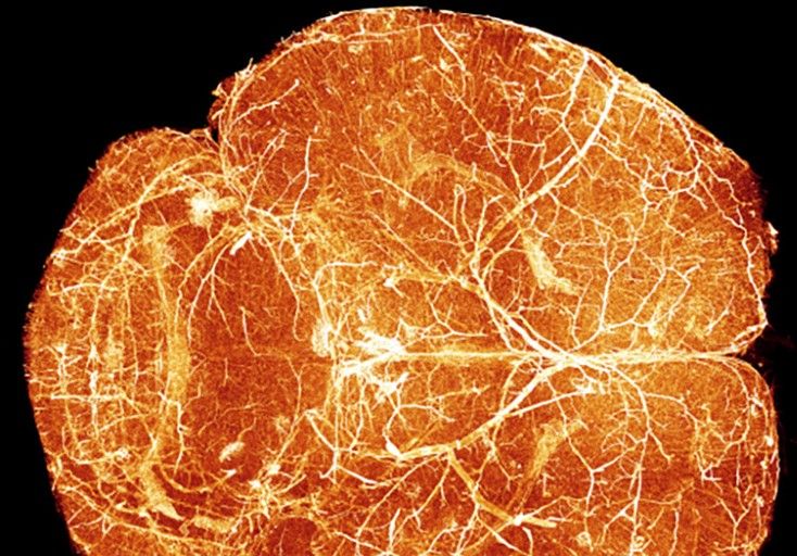 Karte der Hirnentwicklung  Forscher der Université de Montréal haben in Zusammenarbeit mit dem Paris Brain Institute den nach eigenen Angaben ersten detaillierten Atlas erstellt, der zeigt, wie sich das Gefäßnetzwerk im Gehirn einer Maus nach der Geburt entwickelt.  Ihre Studie zeigt: Blutgefäße im Gehirn wachsen nicht einfach parallel zu den Neuronen. Stattdessen folgt das Wachstum einer dynamischen Entwicklung in mehreren Phasen, die je nach Hirnregion variiert und eng mit der Reifung neuronaler Schaltkreise verknüpft ist. Die Blutgefäße spielen damit eine aktive Rolle beim Aufbau des Gehirns nach der Geburt.  Das Bild zeigt die Blutgefäße im Gehirn einer neugeborenen Maus.   Hier gehts zur Originalmeldung Wissenschaftsbild des Tages vom 30.4.2026  (Bild: 3D digital atlas Lambada)