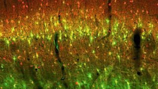 Im histologischen Hirnschnitt wurden Teile der extrazellulären Matrix (grün), die die Nervenzellen (rot) umgibt, angefärbt und unter dem Mikroskop analysiert.  (Eike Budinger und Julia Henschke/LIN Magdeburg)