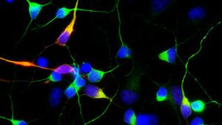 Nervenzellen unter dem Mikroskop: Die rot markierten produzieren den Botenstoff Dopamin. (Bild: DZNE/M. Deleidi)