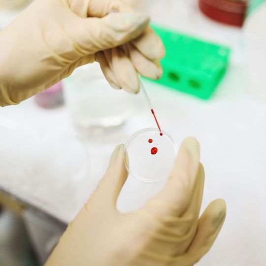 The team trained artificial intelligence software to identify the specific patterns of DNA fragments seen in the blood of 576 people with or without lung cancer. (Source:  free licensed / Pexels)