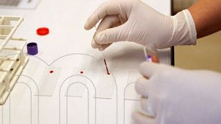 Mithilfe von Bluttests kann u.a. das Cholsterin analysiert werden.  (Bild: Medizinische Universität Wien)