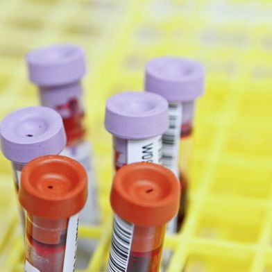 Künftig könnte der Elecsys pTau181 Bluttest genutzt werden, um Alzheimer anhand von Blutproben auszuschließen. (Symbolbild) (Bild: frei lizenziert/ National Cancer Institute)