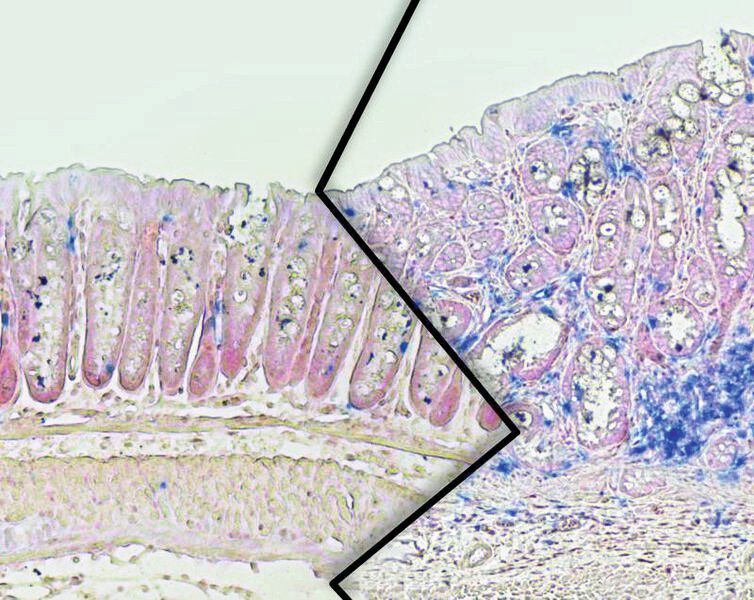 Dickdarmgewebe aus schlanken (links) und übergewichtigen (rechts) Mäusen. Bei den übergewichtigen Tieren ist das Tumorwachstum verstärkt und die Zahl von Immunzellen erhöht (blau). (© MPI f. Stoffwechselforschung/Wunderlich)