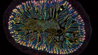 This tissue section, taken from the intestine of a mouse unable to produce the neuropeptide VIP, clearly shows the striking frequency with which certain cell types occur on the intestine's surface. These include villous cells (red), mucus-producing goblet cells (yellow), Paneth cells (pink) and stem cells (green).  (Source: © Charité | Luisa Barleben)