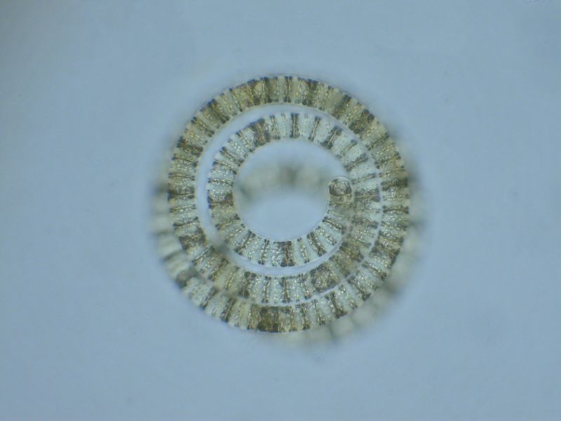 Cyanobakterium (Blaualge) Arthrospira fusiformis unter dem Mikroskop. Es bildet in den Sodaseen unglaublich dichte Biomassen, die Spinat ähnlich aufrahmen können. (Bild: Michael Schagerl)
