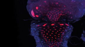 In Fruchtfliegen mit defektem Apterous-Gen verschließt ein korkenähnliches Gebilde, der Reingers-Knoten (rot), den Hinterdarm (blau).  (Bild: Biozentrum, Universität Basel)