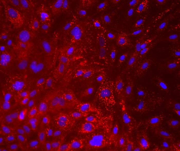 Milchproduktion mit mehr Tierwohl  Moderne Milchkühe produzieren enorme Mengen Milch, was oft zu Entzündungen und Zellstress in ihren Eutern führt. Forscher der Hebräischen Universität Jerusalem haben nun entdeckt, dass mesenchymale Stammzellen (MSC) und deren Sekrete helfen können, die Euterzellen vor Stress zu schützen und die Fettproduktion der Milch zu steigern.  In ihrer Studie fanden sie heraus, dass MSCs und ihre „Sekretome“, eine Vielzahl von Signalmolekülen, Entzündungen reduzieren und die Fettproduktion ankurbeln. Diese Effekte traten auch ohne direkten Zellkontakt auf, was bedeutet, dass die Moleküle potenziell als Futterzusatz verabreicht werden könnten. Dies könnte nicht nur die Milchproduktion und -qualität verbessern, sondern auch die Gesundheit der Tiere fördern.  Auf dem Bild zu sehen sind Milch produzierende Zellen einer Milchkuh. Die roten Punkte sind Fetttröpfchen innerhalb der Zellen, die mit einem Farbstoff namens Nile Red gefärbt wurden. Die blauen Bereiche zeigen die Zellkerne. Mesenchymale Stammzellen und deren „Sekretome“ helfen, Stress zu reduzieren und die Lipidproduktion zu steigern. .Hier gehts zur Originalmeldung Wissenschaftsbild des Tages vom 17.7.2025  (Bild: Noam Tzirkel-Hancock)