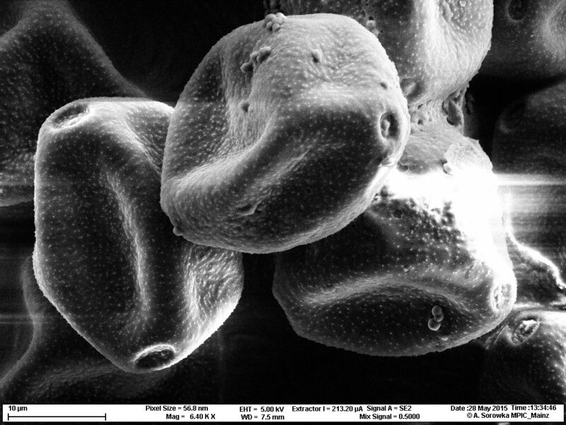 Elektronenmikroskopische Aufnahme von Haselpollen: Haselpollen lösen oft schon im Februar Allergien aus, da die Pflanze früh im Jahr blüht. (Bild: Antje Sorowka, Max-Planck-Institut für Chemie)