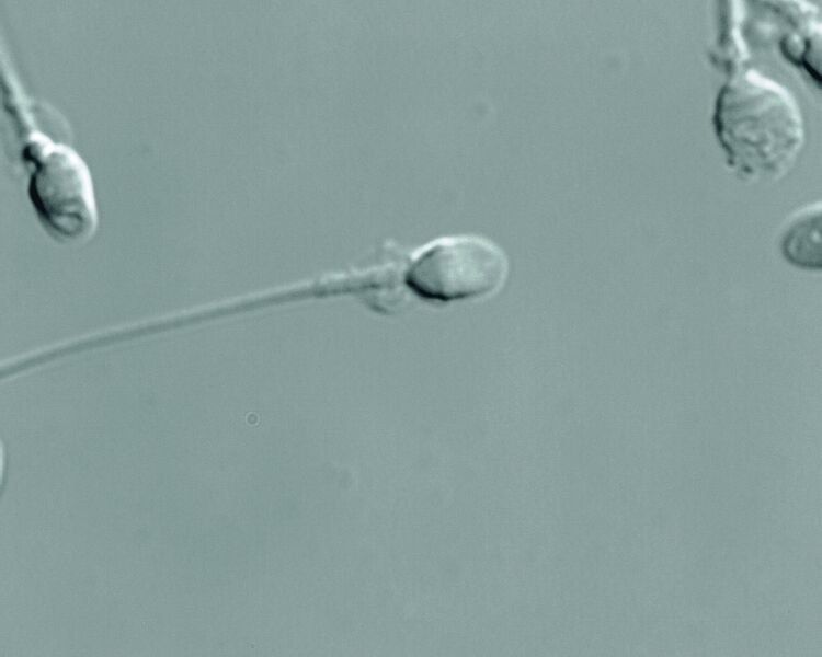 Abb. 2 IMSI-geeignetes Spermium ohne auffällige Morphologie. (Archiv: Vogel Business Media)