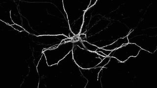 Bild einer lebendigen im Labor gezüchteten Nervenzelle: Die Membran, die sie umgibt, leuchtet hell, da an ihrer Außenseite ein fluoreszierendes Protein sitzt (Milan Pabst)