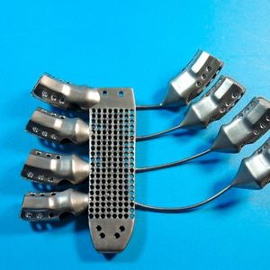 ... und die Rückseite des Titan-Implantats. Auf Basis hochauflösender CT-Daten hat das Medizintechnikunternehmen Anatomics eine 3D-Rekonstruktion von Thoraxwand und Tumor angefertigt.