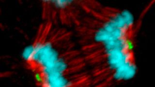 This image shows a cancer cell undergoing abnormal mitosis and dividing into three new cells rather than two following treatment with a microtubule poison. (Source: Beth Weaver/ UW–Madison)