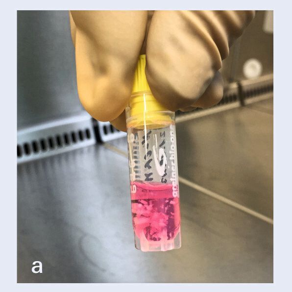 Vorbereitung des Knorpelimplantats N-TEC: Der Nasenknorpel wird zerkleinert und die Knorpelzellen werden isoliert. (Bild: TERM / UKW)