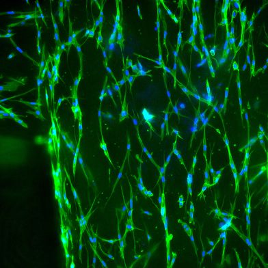 Im Projekt PhysioINK entwickeln Fraunhofer-Forschende Bio-Drucktinten aus den gängigsten Gewebeproteinen. Unter dem Mikroskop sind die lebenden Gewebezellen (Fibroblasten) in der gedruckten Gitterstruktur erkennbar: Blau ist der Zellkern, grün das Zytoskelett. (Bild: Tobias Weigel/Fraunhofer ISC)