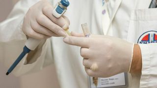 Auch in klinischen Laboren wird bereits seit einigen Jahren verstärkt die LC-MS/MS eingesetzt. (gemeinfrei)