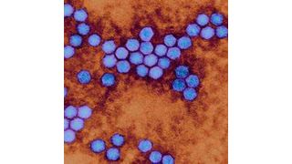 Das Polio-Virus, Erreger der auch als Kinderlähmung bezeichneten Poliomyelitis (Bild: Dennis Kunkel Microscopy, Inc.; Quelle: theguardian)