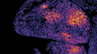 Oxidantienbildung in der Leber – mit einem neuen Biosensor auf einem Gewebeschnitt sichtbar gemacht. (Bild: © Tobias Dick, DKFZ)