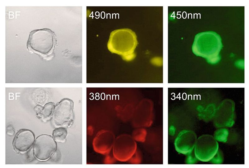 Humane Organoide gezüchtet aus Dünndarmgewebe (Zwölffingerdarm, Duodenum). Transportvorgänge und intrazelluläre Signalprozesse können in Organoiden mittels pH-sensitiven Farbstoffen (obere Reihe) und Calcium-Indikatoren (untere Reihe) sichtbar gemacht und damit auch im Detail erforscht werden. (Bild: E. Rath / TUM)