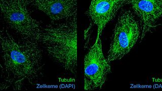 Immunfluoreszenzaufnahmen von Tubulin (grün) und Zellkernen (blau) in unbehandelten (links) und Glyoxal-behandelten Endothelzellen (rechts). Die Glykierung von Tubulin durch Glyoxal führt zu veränderter Mikrotubuli-Dynamik und Hemmung der Zellteilung. (Bild: Institut für Molekulare Zellbiologie / UKJ / Katrin Spengler)